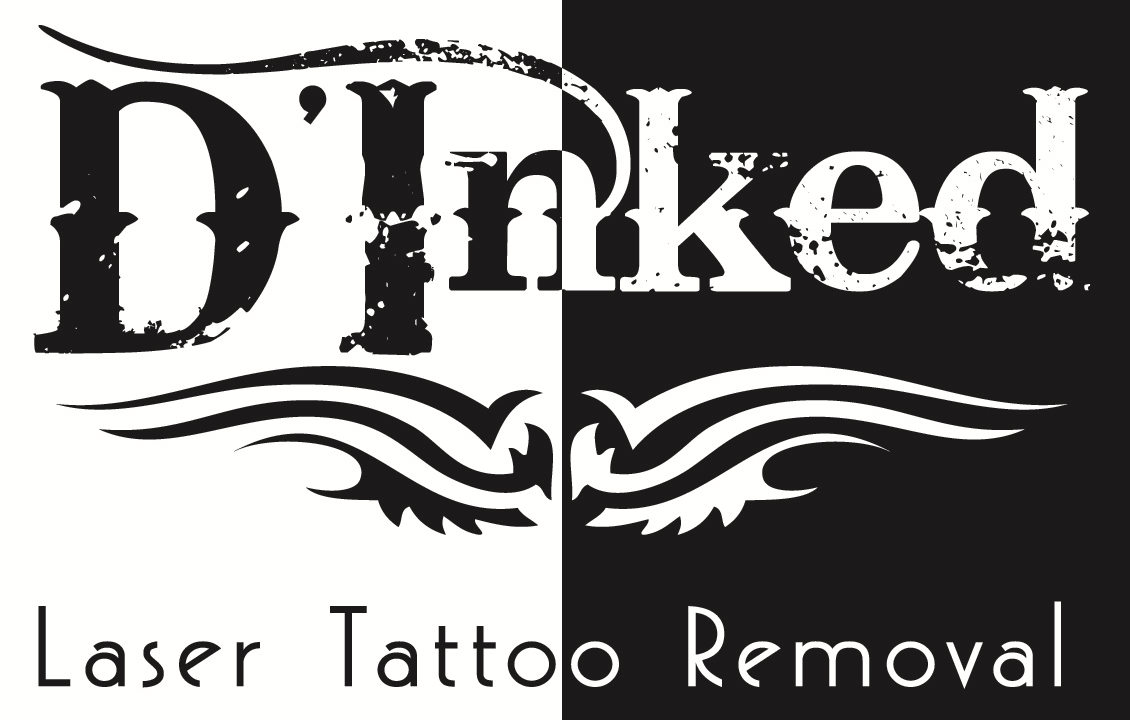 Tattoo Removal in Virginia Beach  Book Your Consultation  The Skin Chic