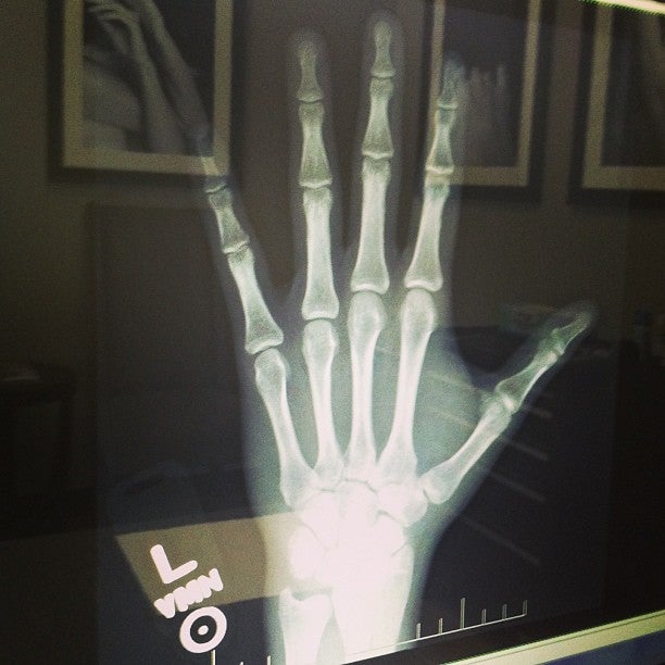 The Hand and Wrist Institute, 8929 Wilshire Blvd, Beverly Hills, CA