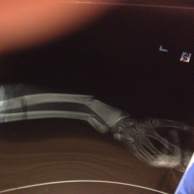 Medina Memorial Hospital, 200 Ohio St, Medina, NY, Pharmacies MapQuest