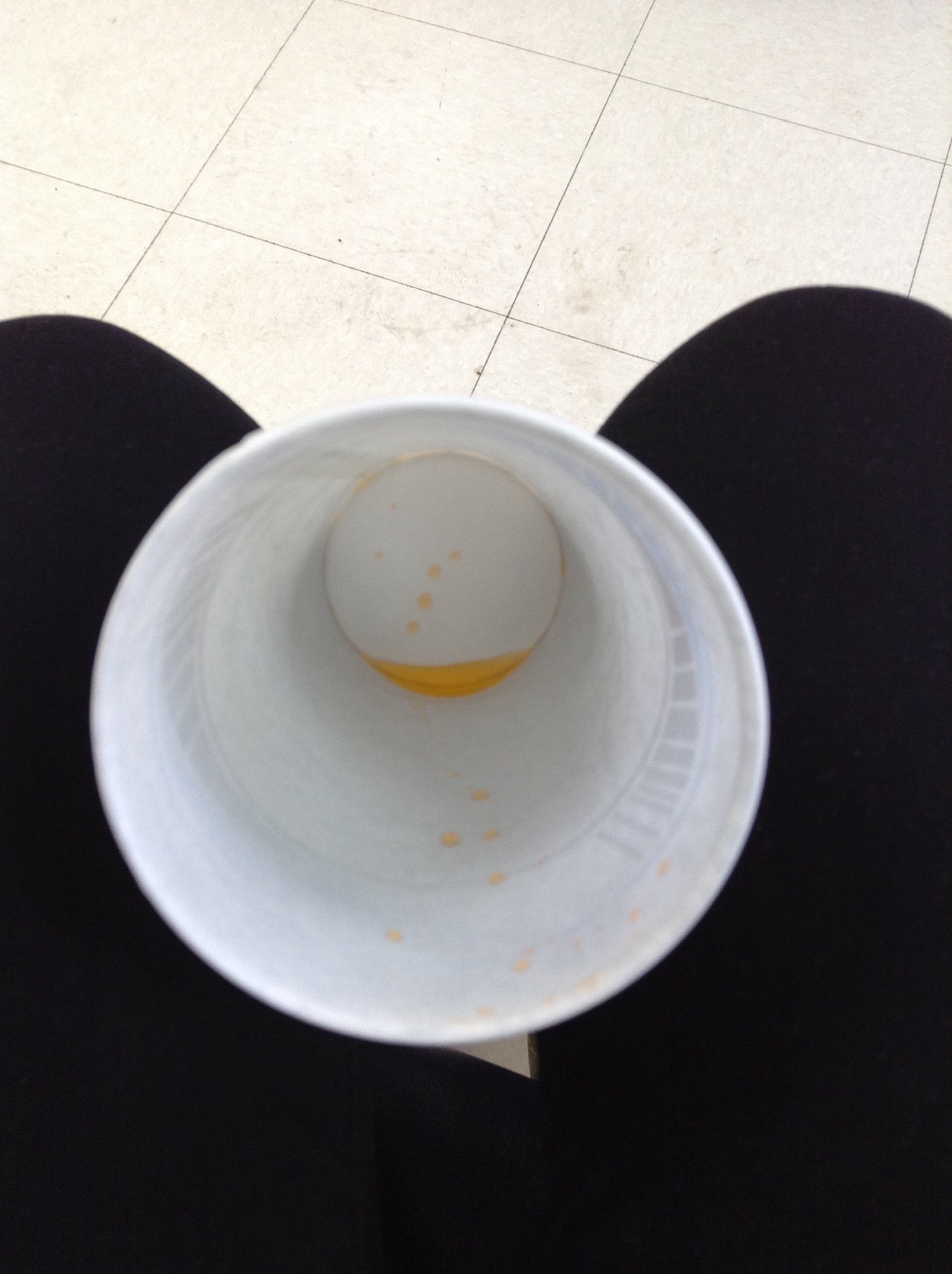 Calgary Laboratory Services