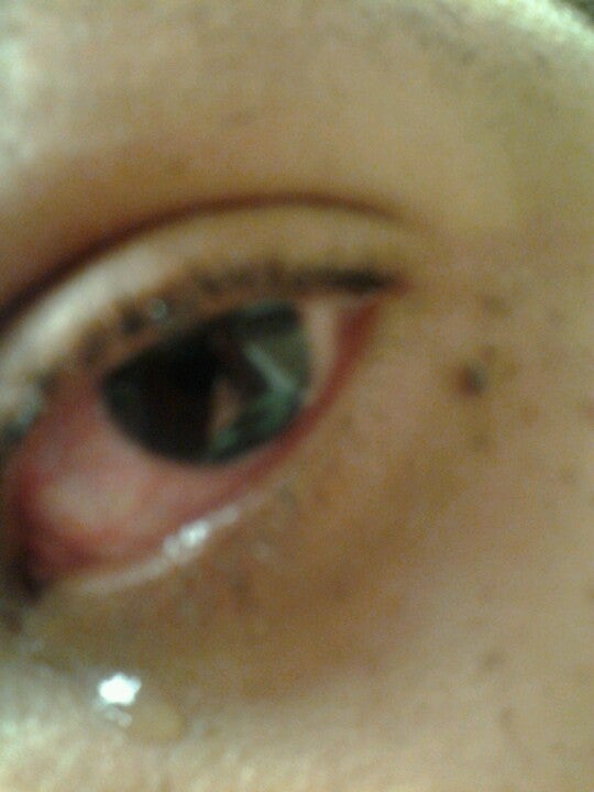 Olde Towne Eye Care Dr S' Damron, & Li Optometry, 226 Fort Ln