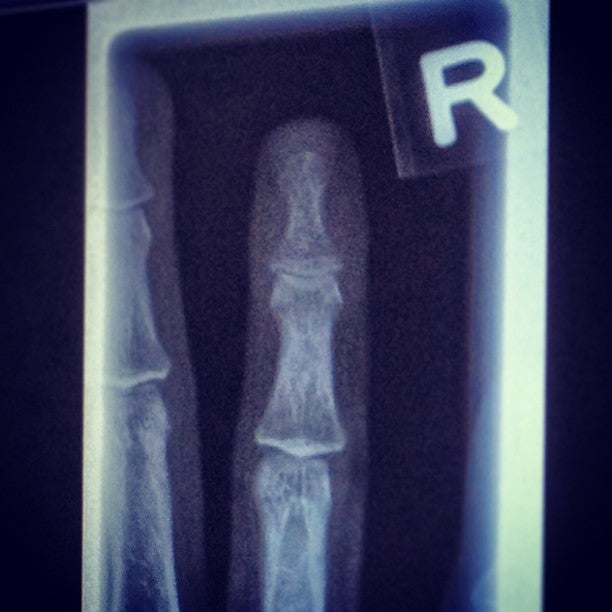 Kaye Edmonton Clinic, 11400 University Ave NW, Edmonton, AB MapQuest