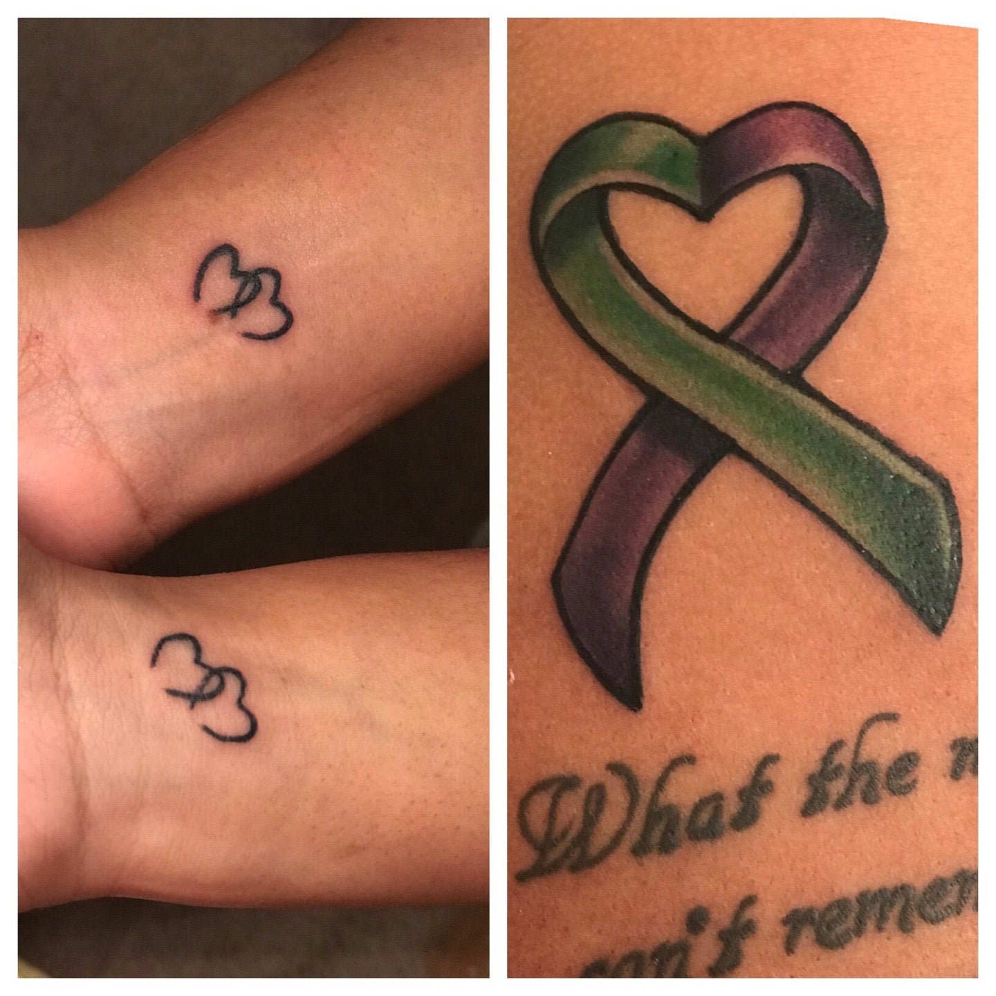 Is it safe for a person with epilepsy to get a tattoo