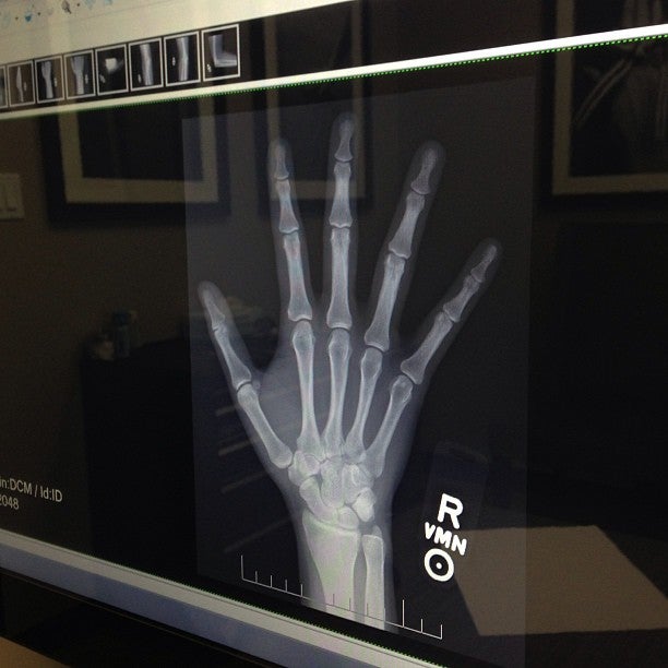 The Hand and Wrist Institute, 8929 Wilshire Blvd, Beverly Hills, CA