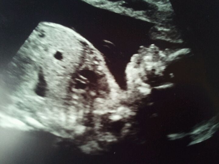 Community Radiology Associates, 67 Thomas Johnson Dr, Suite 4